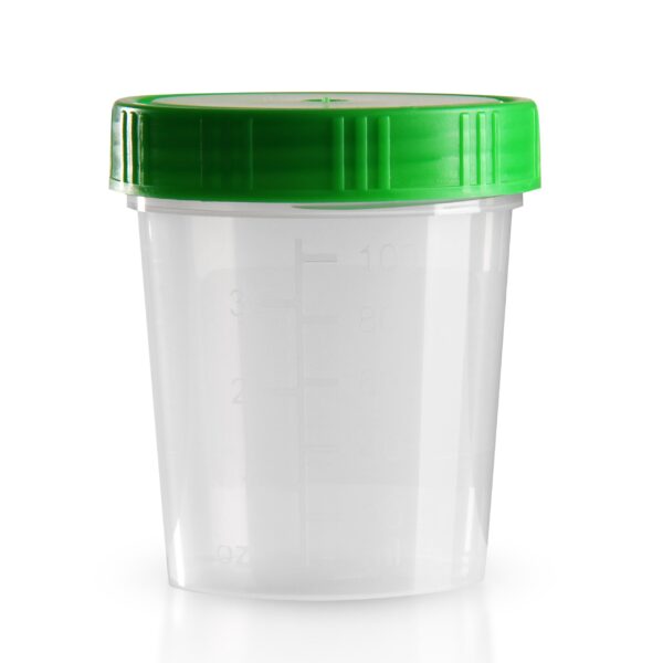TUMBLER URINE